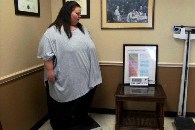 229 kiloqram arıqlayıb bu hala düşdü -  FOTOLAR